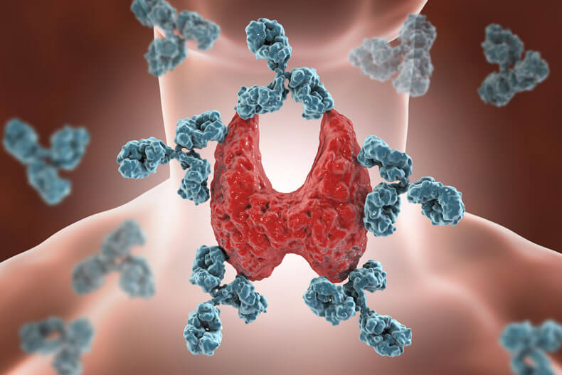 Autoimmune Disease Treatment Perth  – Reversing Autoimmunity