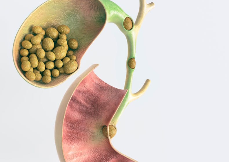 Gallbladder Disease And Gallstones Functional Medicine