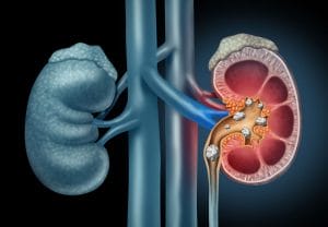 Urinary system issues