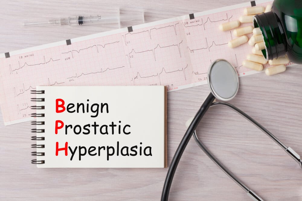 Benign Prostatic Hyperplasia (BPH)- Enlarged Prostate