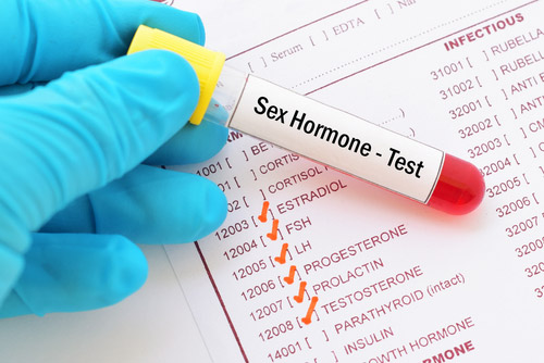 dutch hormone testing