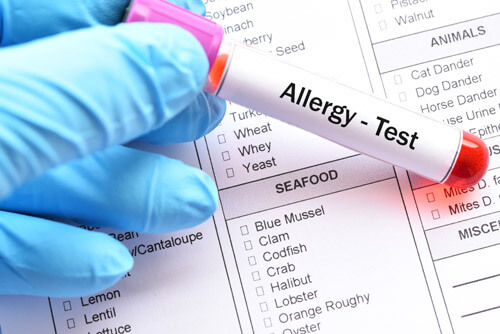 Food-intolerance-Allergy-test