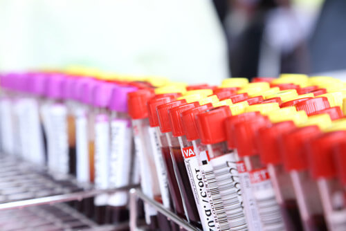 blood-chemistry-panel-testing