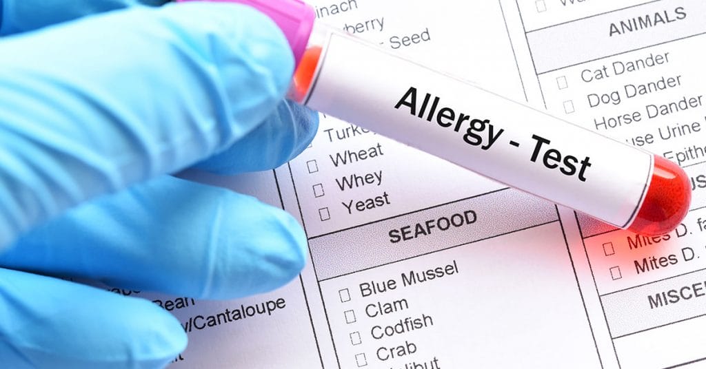 allergy test perth