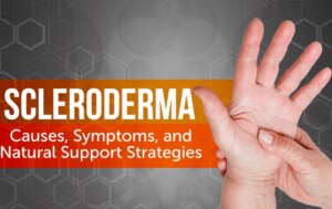 Natural Treatment of Scleroderma