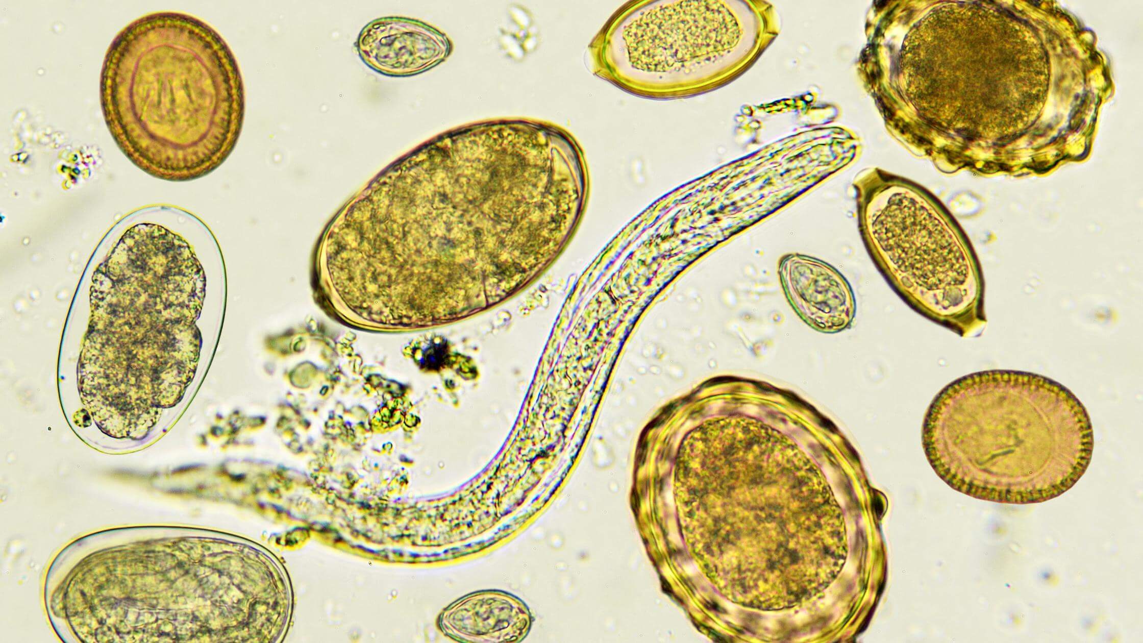 Blastocystis Parasite – What Is It And Why You Want To Get Rid Of It